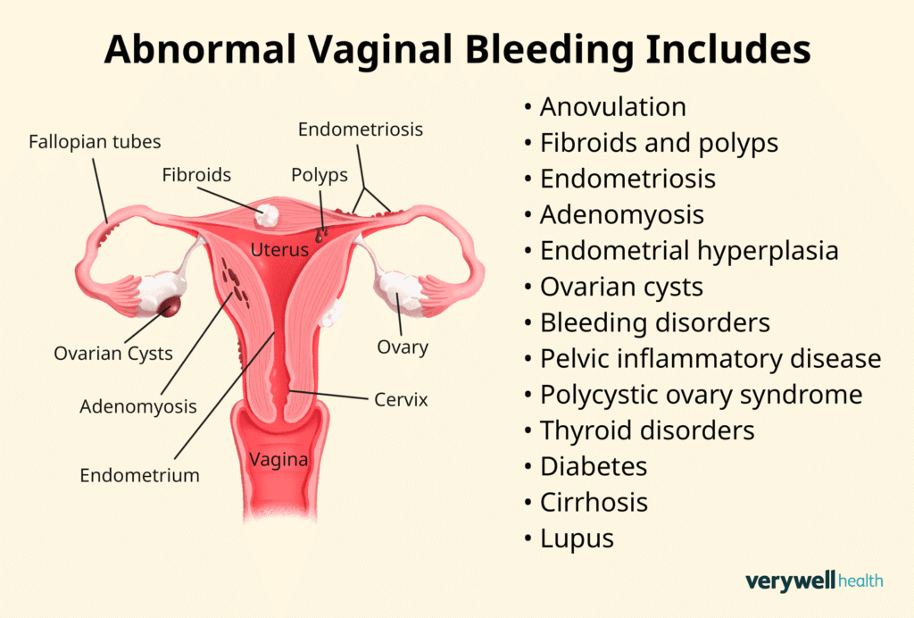 vaginal bleeding causes